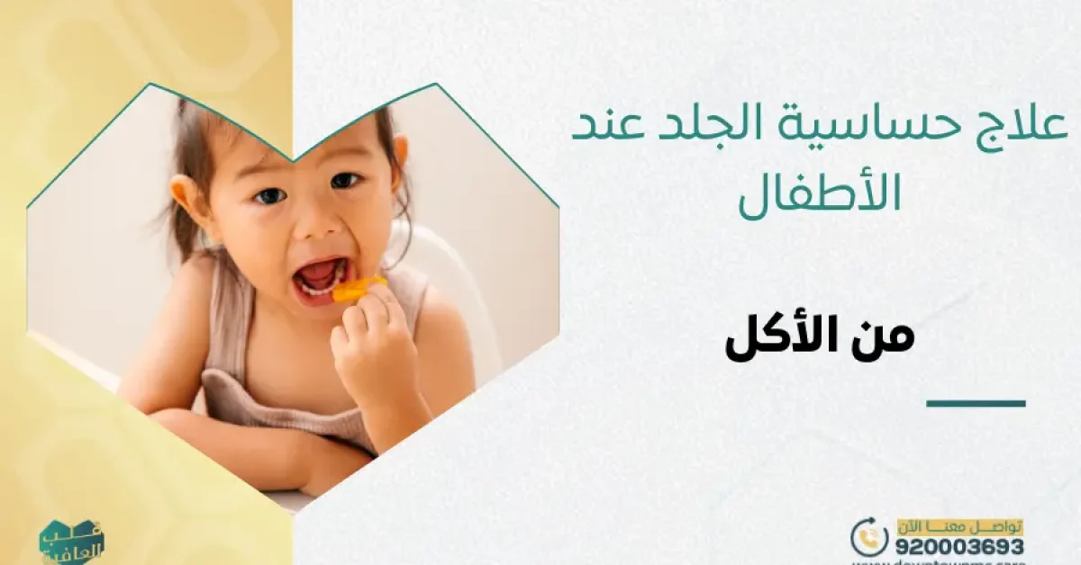 علاج حساسية الجلد عند الأطفال من الأكل
