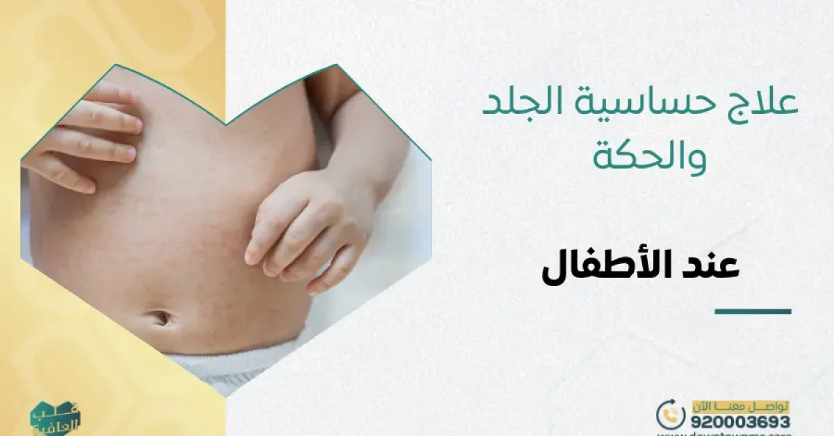 علاج حساسية الجلد والحكة عند الأطفال