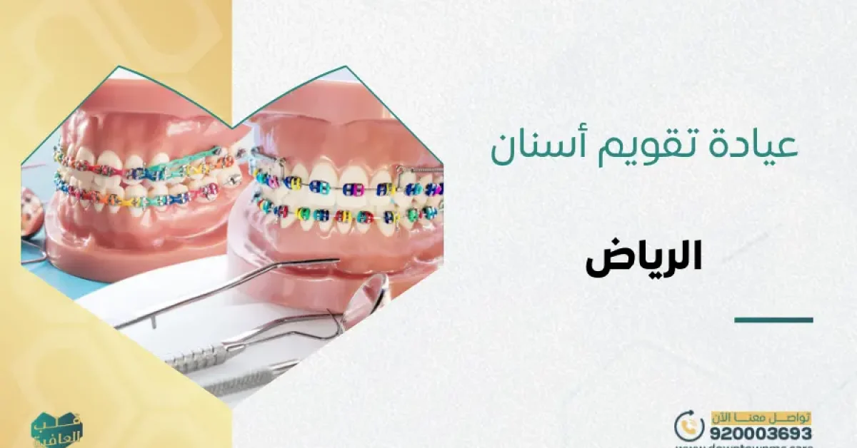 عيادة تقويم أسنان الرياض