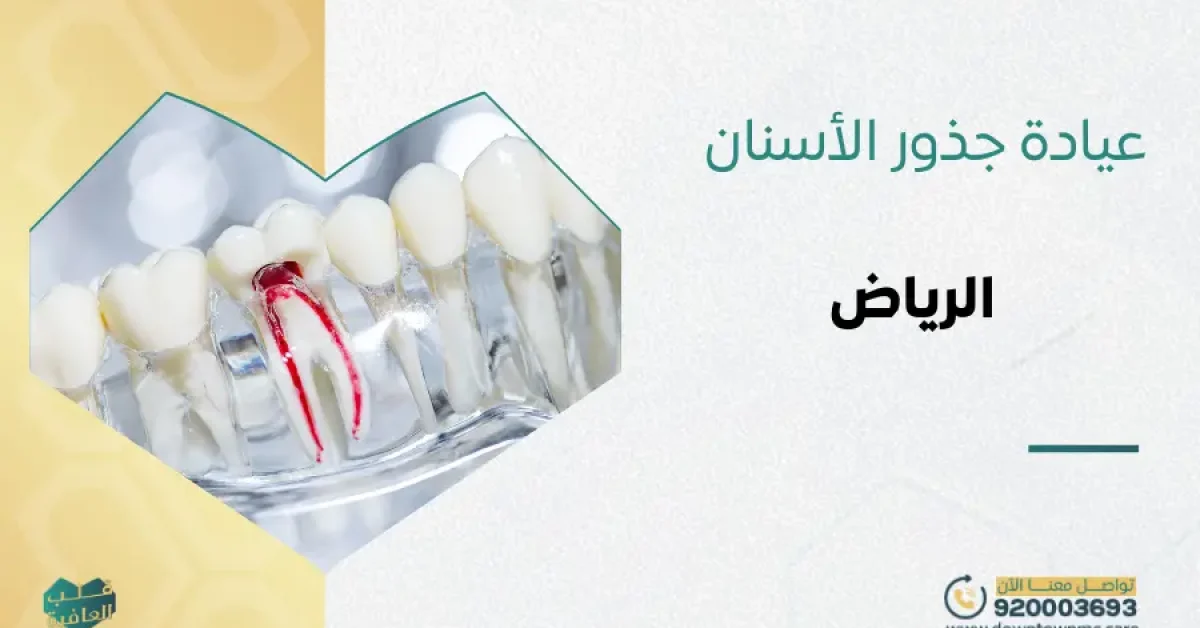 عيادة جذور الأسنان في الرياض