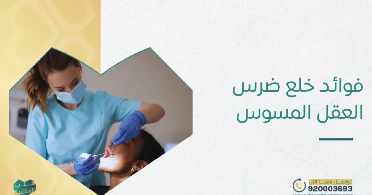فوائد خلع ضرس العقل المسوس
