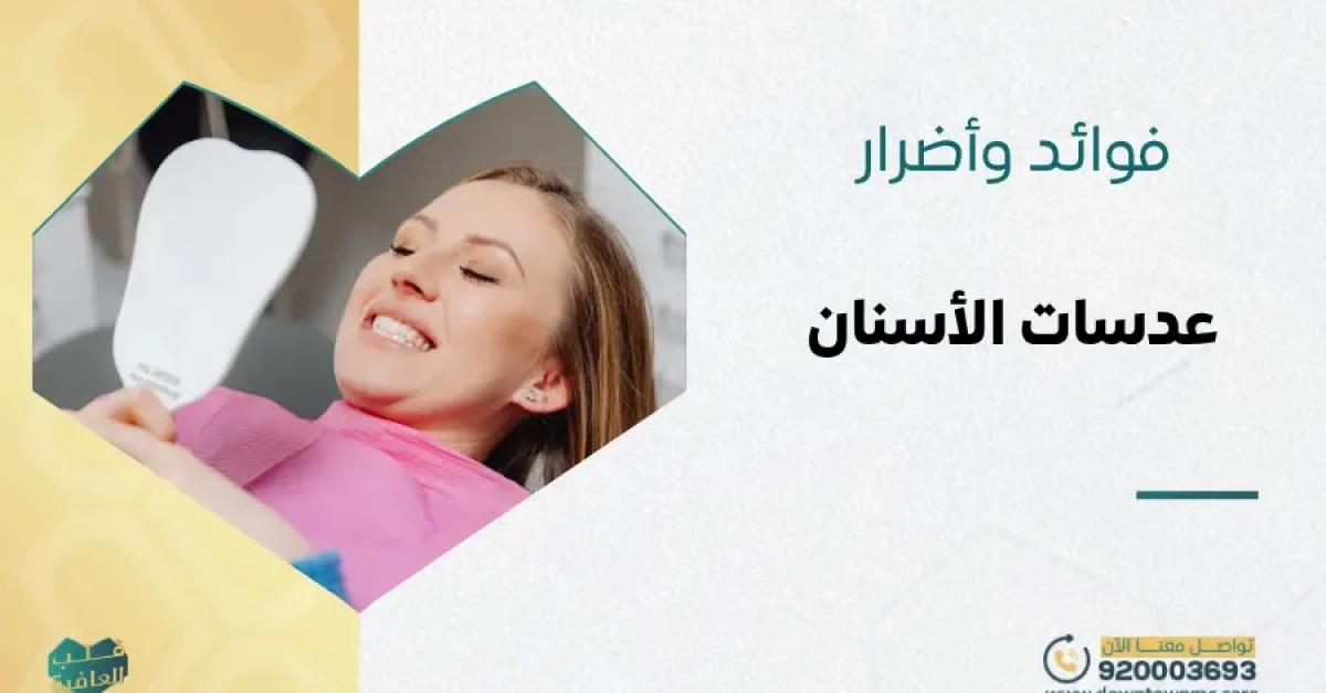 فوائد وأضرار عدسات الأسنان