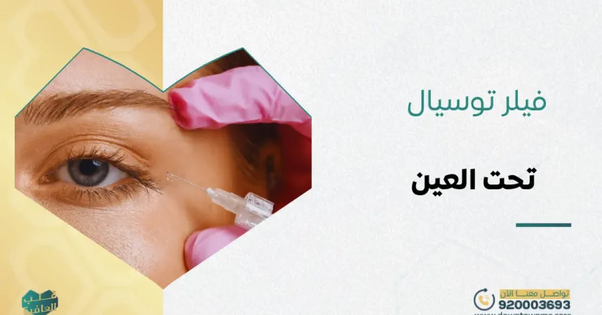 فيلر توسيال تحت العين