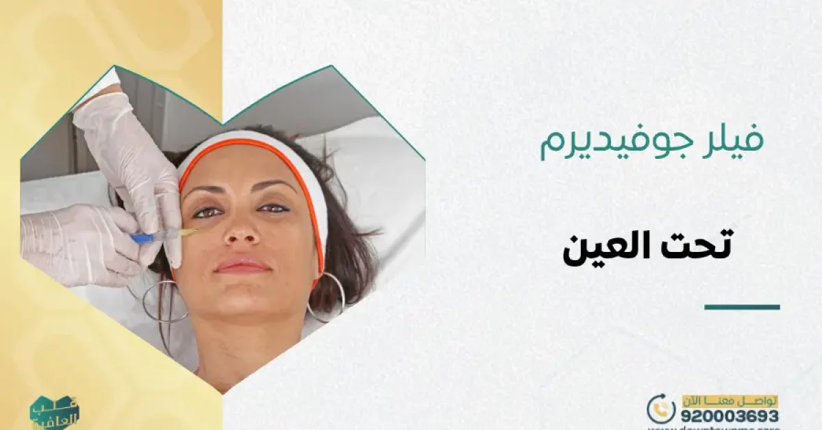 فيلر جوفيديرم تحت العين