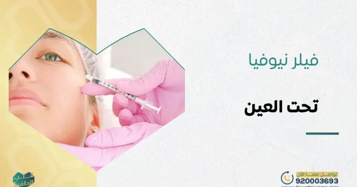 فيلر نيوفيا تحت العين