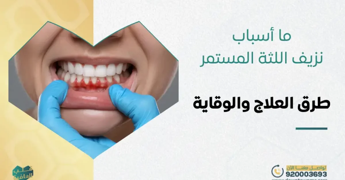ما أسباب نزيف اللثة المستمر وطرق العلاج والوقاية؟