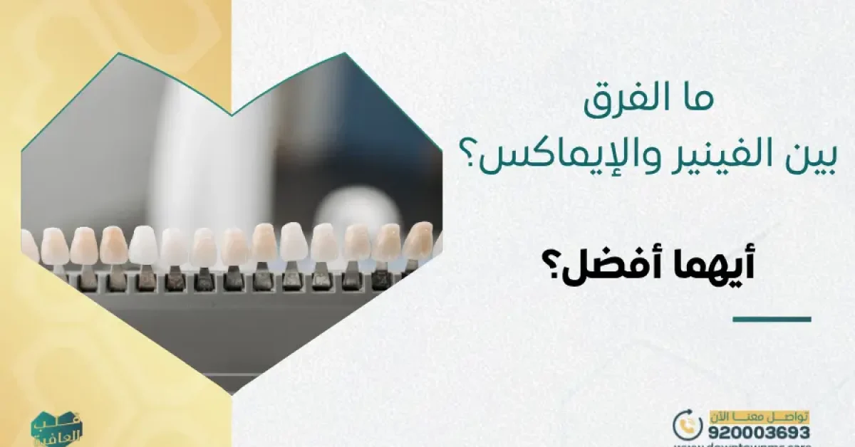ما الفرق بين الفينير والإيماكس؟ وأيهما أفضل؟