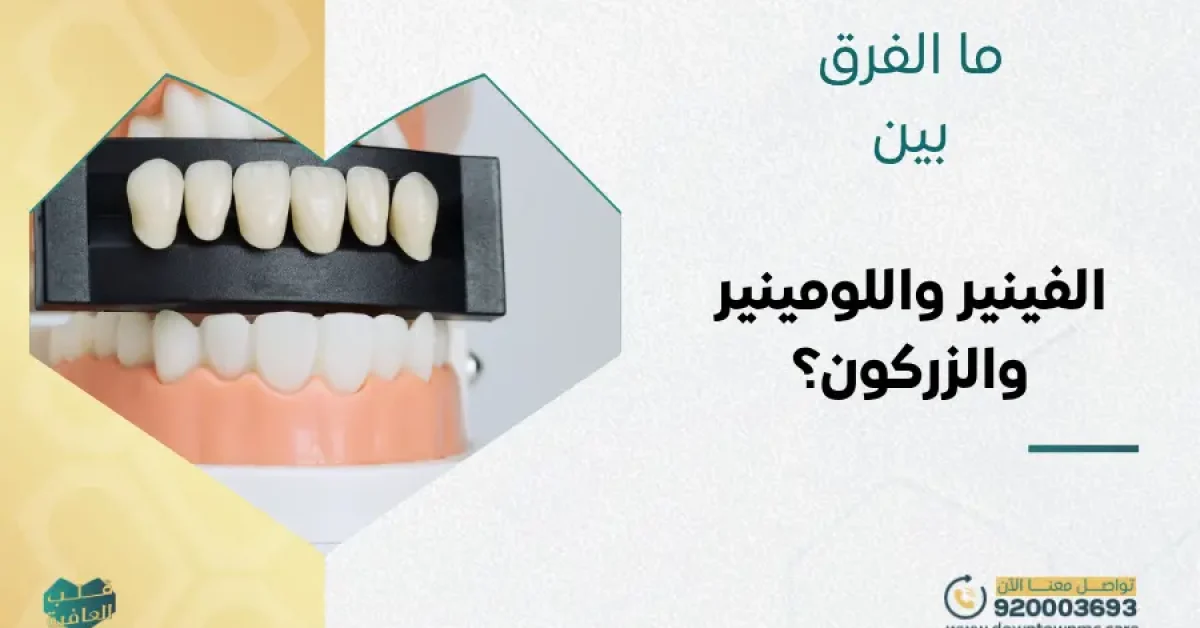 ما الفرق بين الفينير واللومينير للأسنان والزركون؟