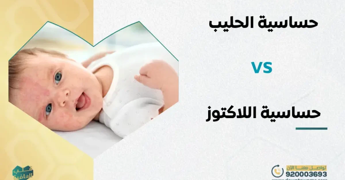 ما الفرق بين حساسية الحليب وحساسية اللاكتوز للأطفال؟