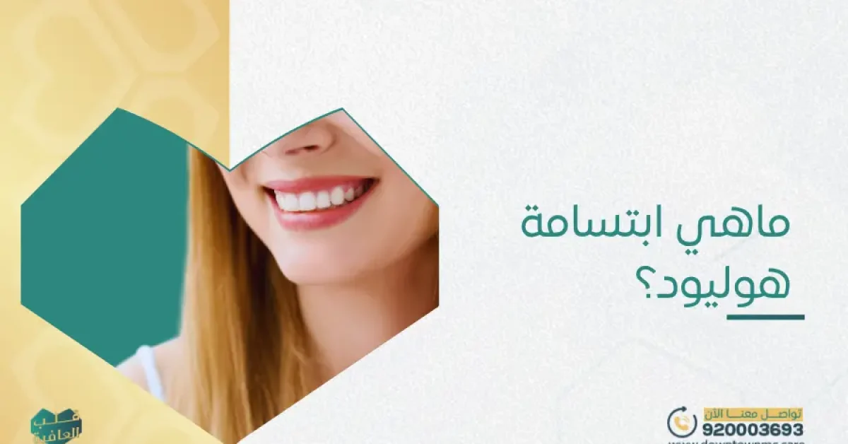 ماهي ابتسامة هوليود