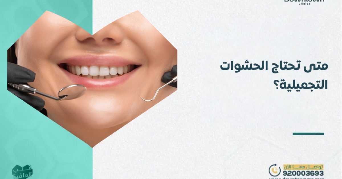 متى تحتاج الحشوات التجميلية؟