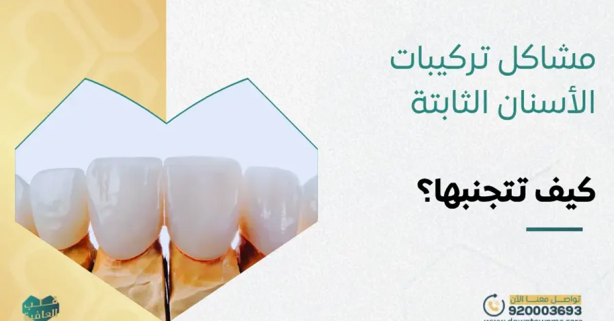 مشاكل تركيبات الأسنان الثابتة
