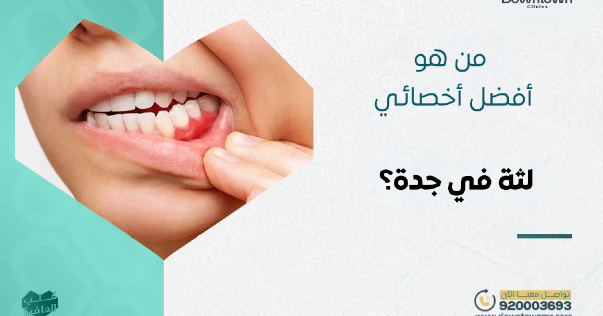 من هو أفضل أخصائي لثة في جدة؟