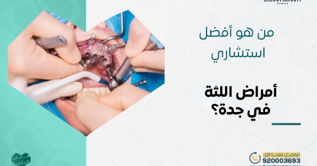 أفضل استشاري أمراض اللثة في جدة